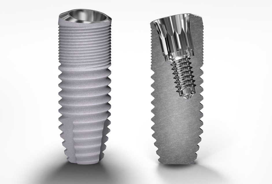 Deep Conical