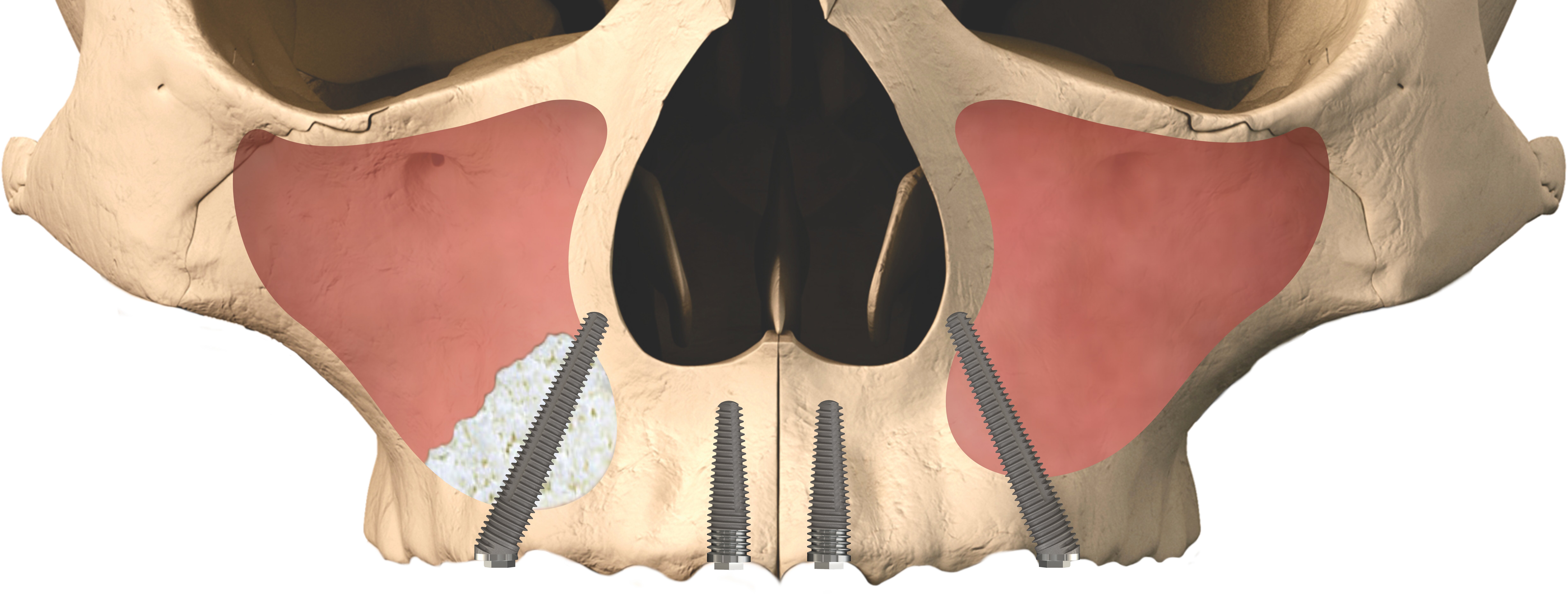 Pterygoid